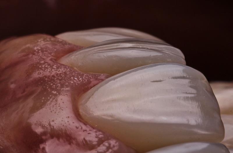 01a5c19ba49260454f20b94224e199d5