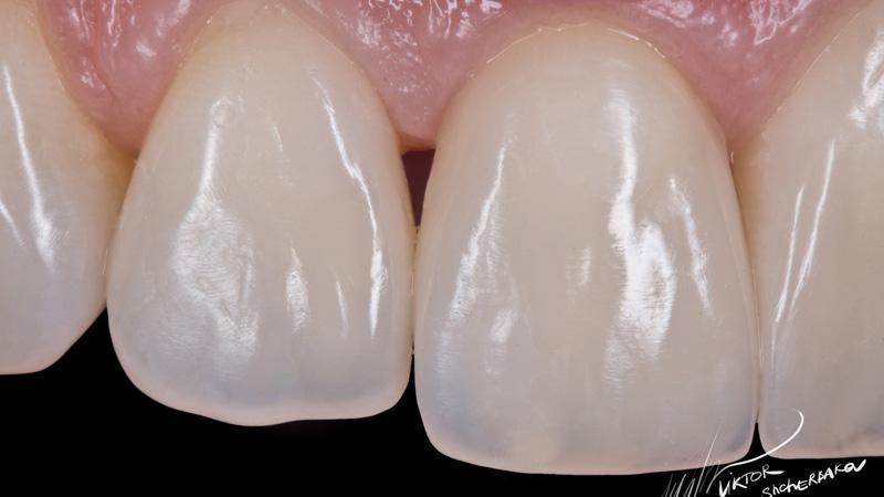 04d181d5ec0ac41a6afc1c270db8b963 (1)