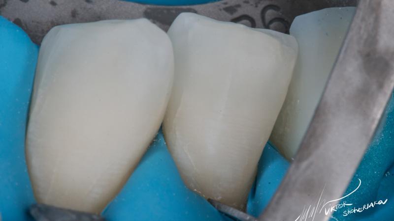 0e884adfff53853b913da05fb6ca8036