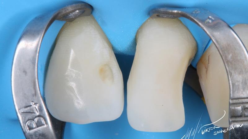 11c5ee1eda83b5a3d9c25a5e528799ee (1)