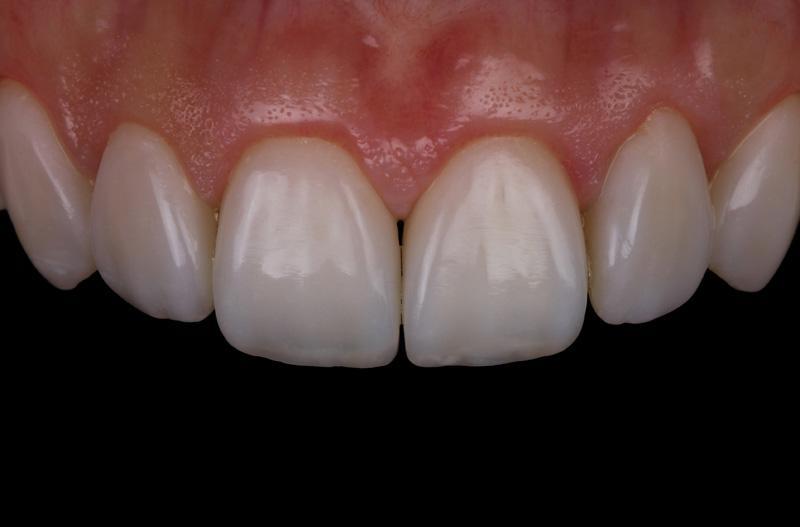 1e77195428d77b3b370b6824080a6874