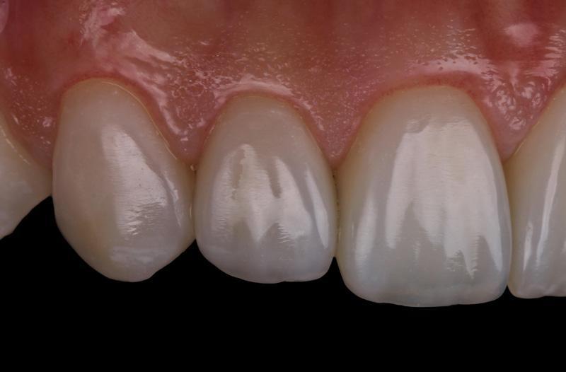 281380f727aa26b40922f3610b0a4429