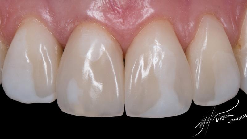 2feac7221e12f14b643f2095d5aee82a (1)