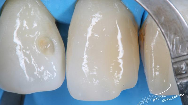 366b734511cfe55ac7e546dfe08999b6 (1)