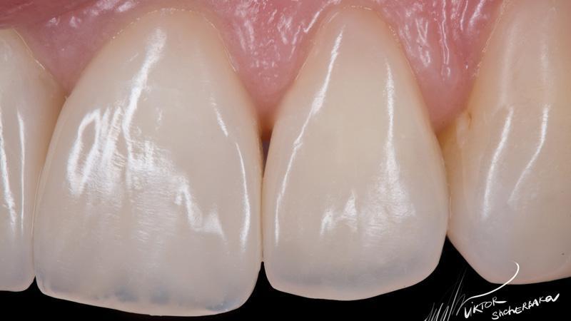 3b4a71455d94932a4a732d2a83b2478f (1)