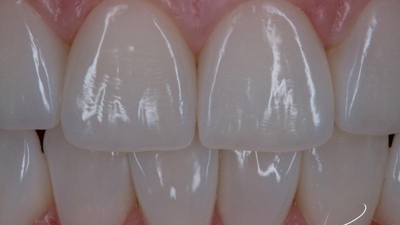 4387d588fa4c750615898f7257376837