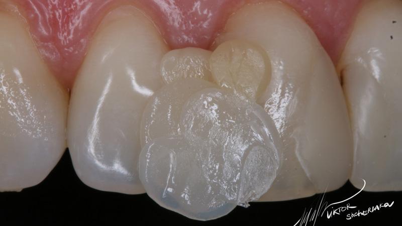 53f4d9465f3d5445348077452488b0cc (1)