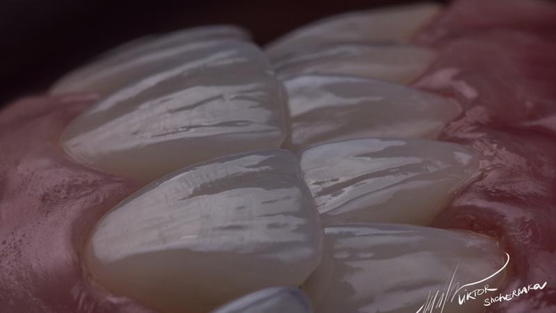 582edde5ff8c27e690192ef0da836c58