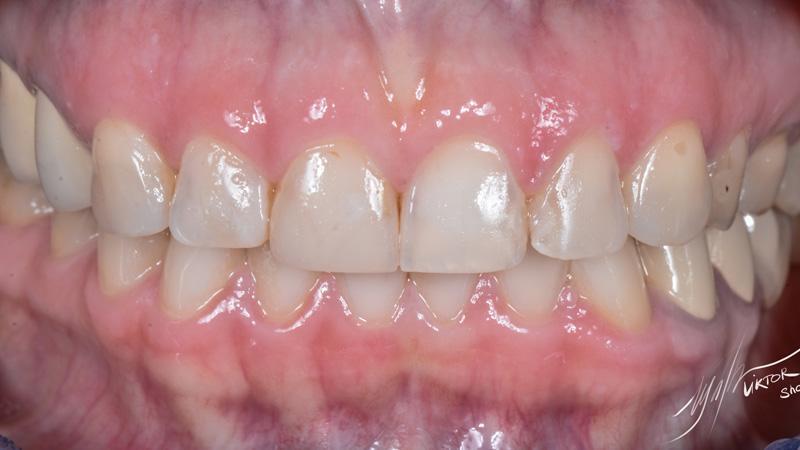 61b29abeddbc23a05e05b0cde8a6ad67