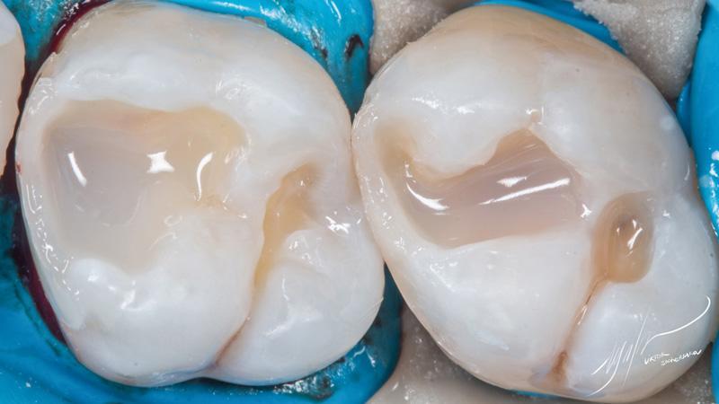 62039852c0435948b31e5a75cc7e5763