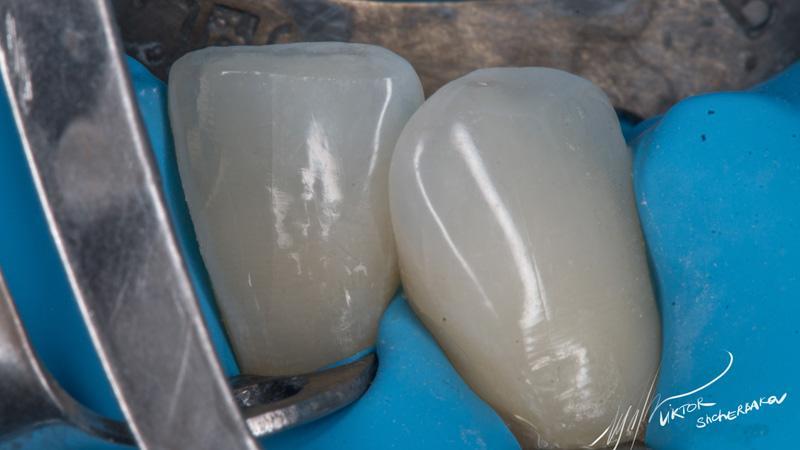 6db6ff3e0870565283fa090462aaae34