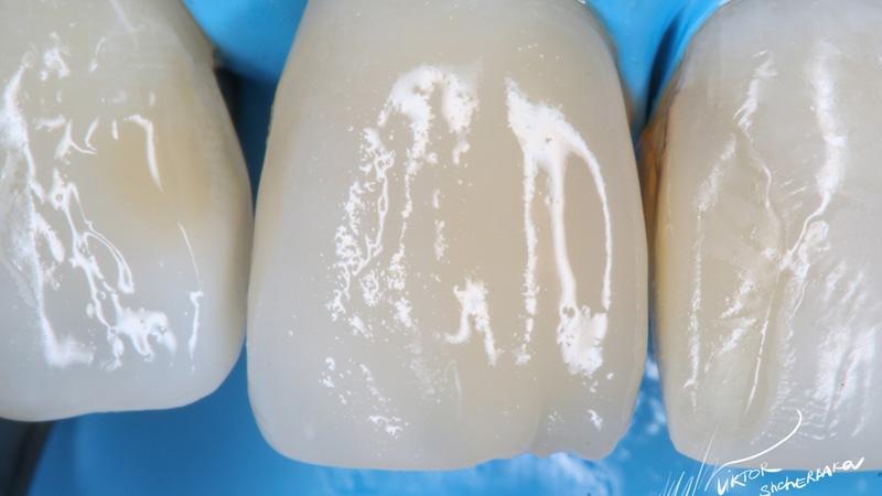 7600ff0fb364a311ce08ae4eb2d8d61c (1)