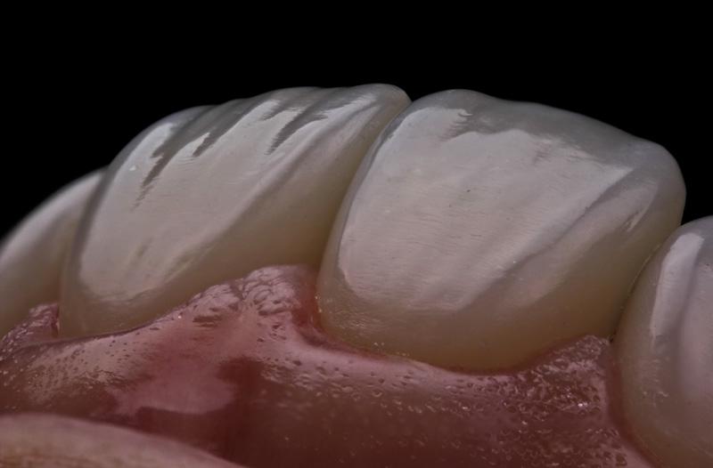 7d66a8191efe902a126614c9eb90fa56