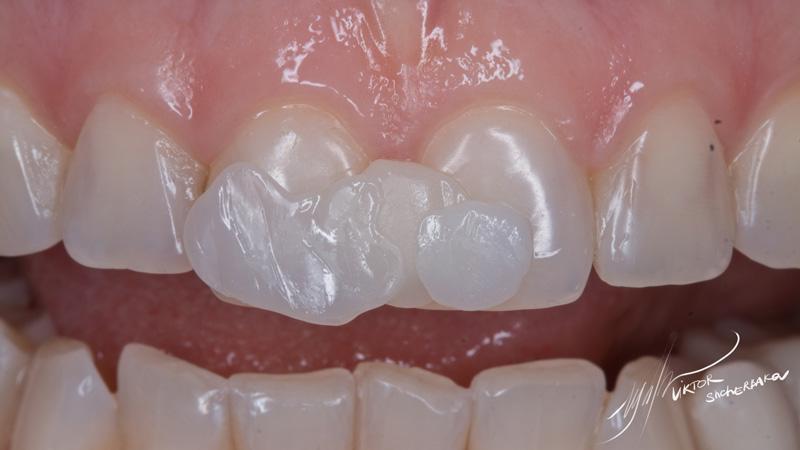 7dbbdbb8562f88d8e71b59691930ad9a