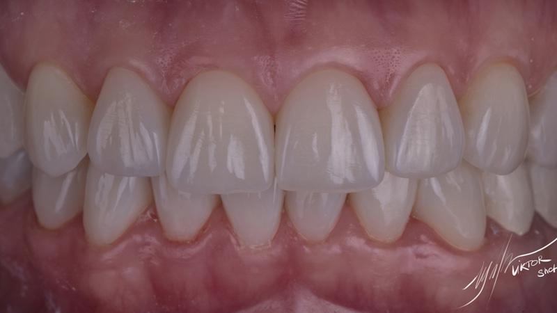 84d155247d41c6f83cd47b5317ee6782