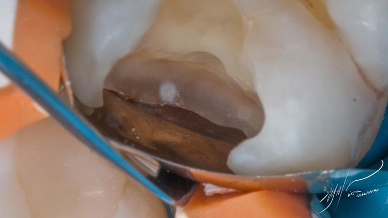 8acfe4812dfbf2f7fd6070d33ad7f1d7