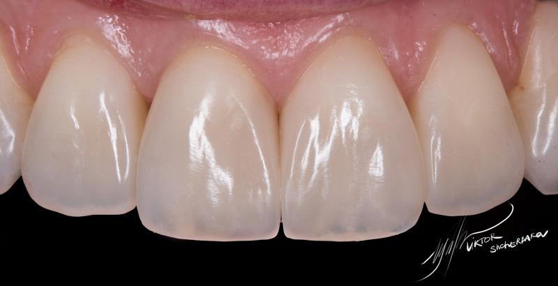 8bbe63583bd6ac861636f7cd7ba9343b (1)