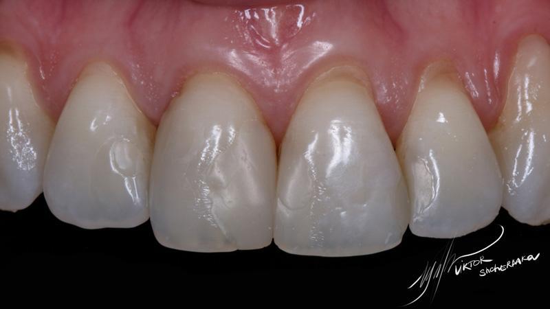 8df5bc78b25ae490d2aaa2d3b730d12e (1)