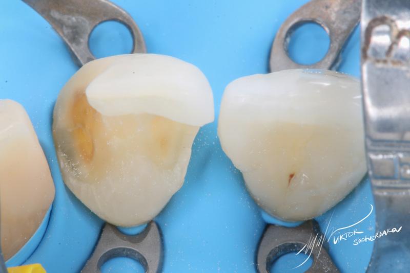 917d4fb152a093c3c013d6f8b93b6b2a (1)