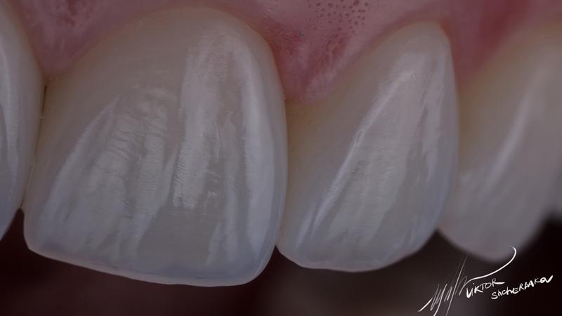 92d8741fbc5e592ea4ebe5d561207caa