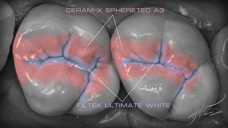 9624fa442005a2de08095e8cf4695731