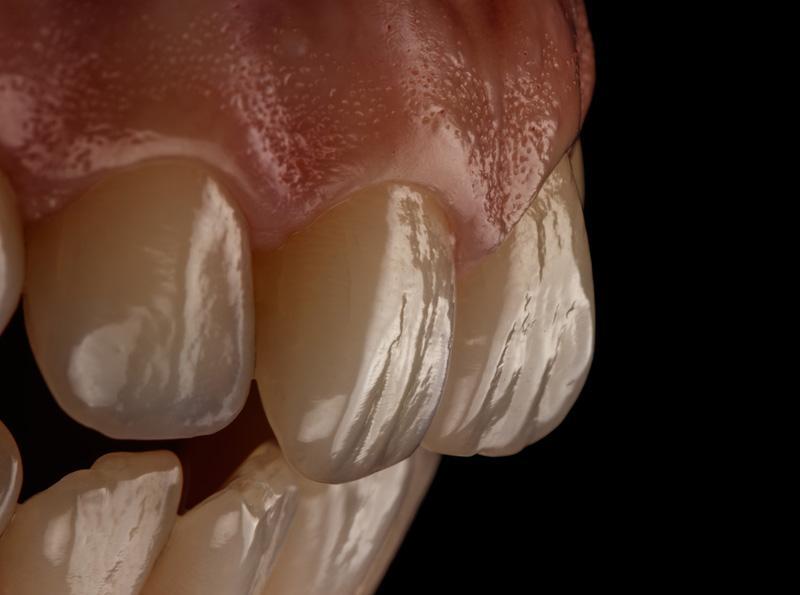 a288eaeb9fc703dc46f9751d378ba858