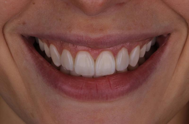 a3e9b61b2589e023fde0c3557986097f