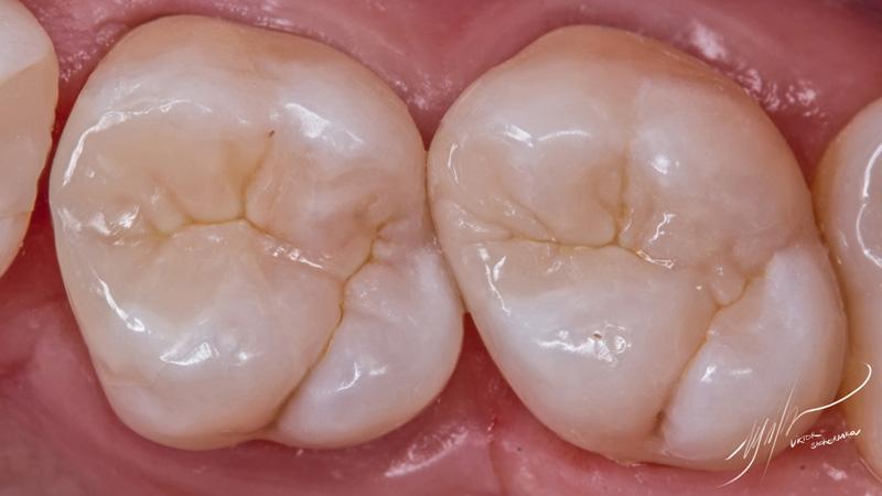 a448f07db4015a709c962c8a6e094786