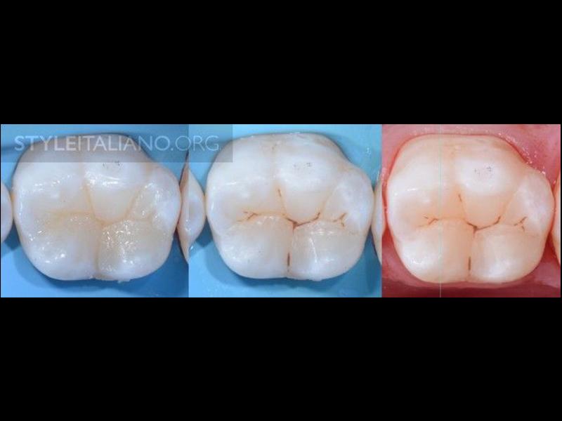 b89cc89c7331b5c0732b72e1cf09ba5e