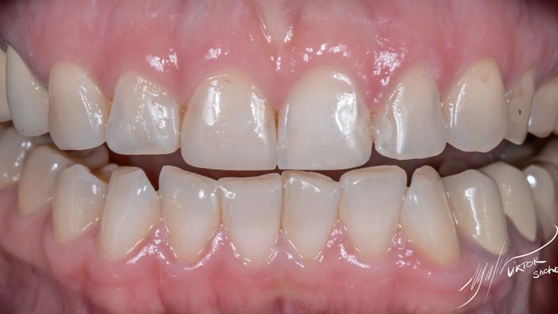 bf2813b6c7ea5aee39ee5cc103aca4ab