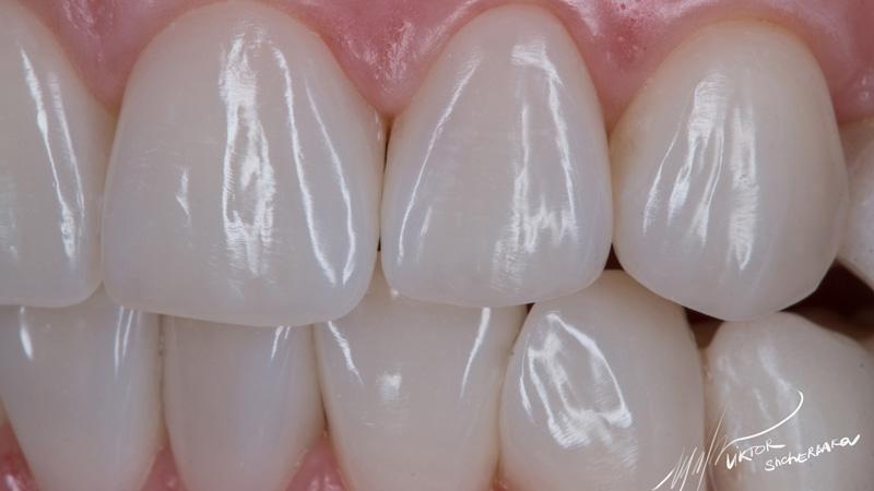 c4466c4f15b55893ea9f3e1a340c58f1