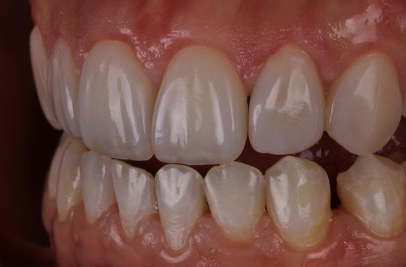 d54e811b905470e99c2c720e62c1a412