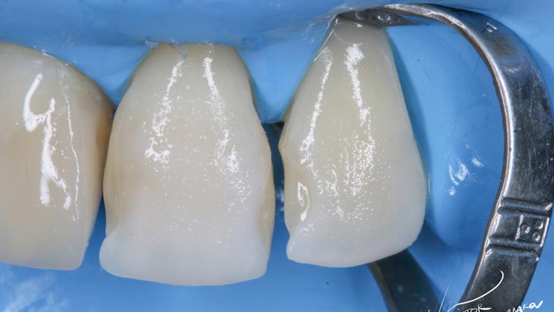 d66914a26c488d12230e100553cb0a50 (1)