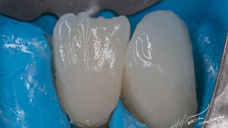 d7d8939552a9f0d3af396dd26dbe5630