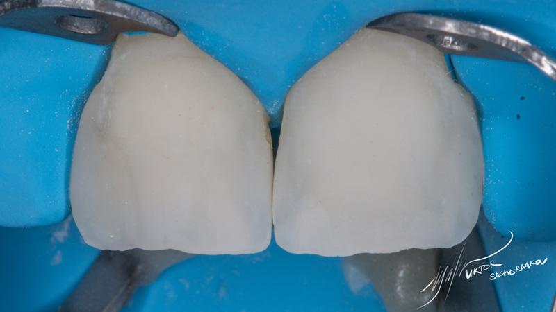 dfb565a420d577ddde066d1762cd08d3