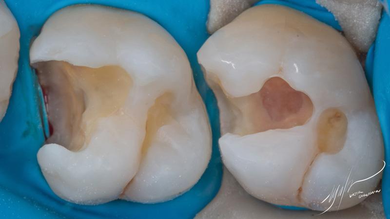 ea68bb255ef668bcb86de49a6bb547be