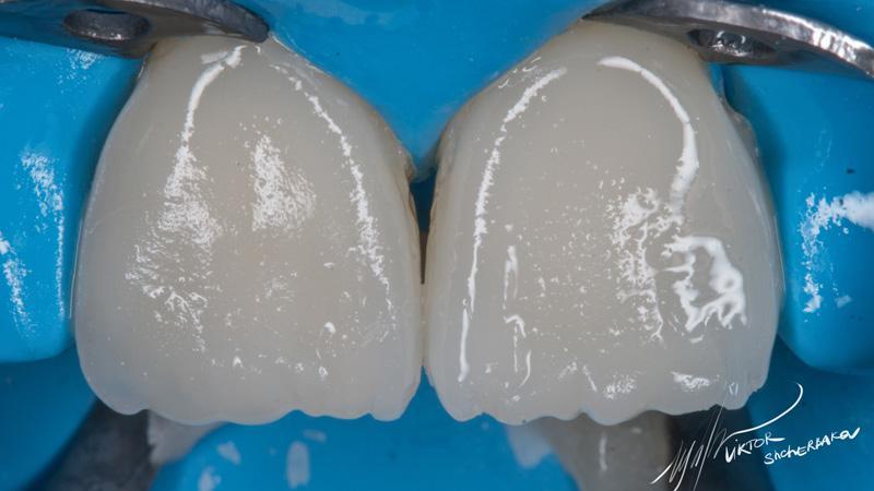 f5a4f7f529d629495df98884e945df75