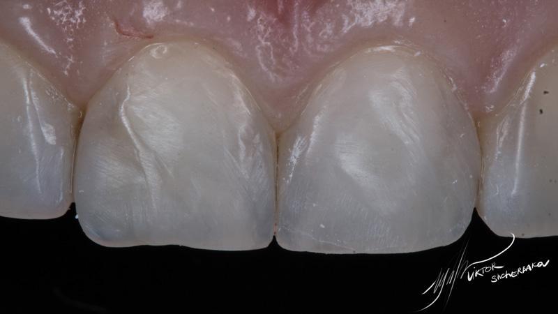 f97b55c762b9bd1df17378fd138cb8ee