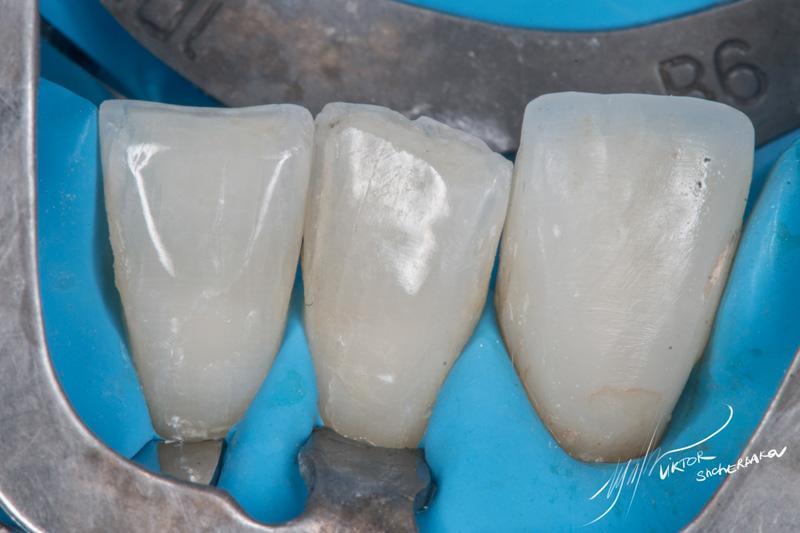 fc8b5a48a62b64fe45c6d7303e564f1e