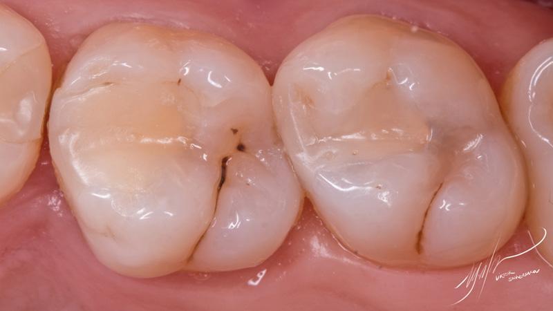 feacd4213d0e6da6cab9dd8d3718a186